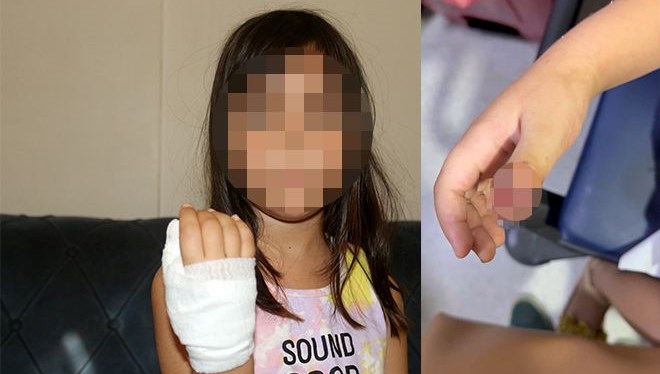 anaokulunda korkunc olay dort yasindaki cocugun parmagi koptu qAcqPLdp